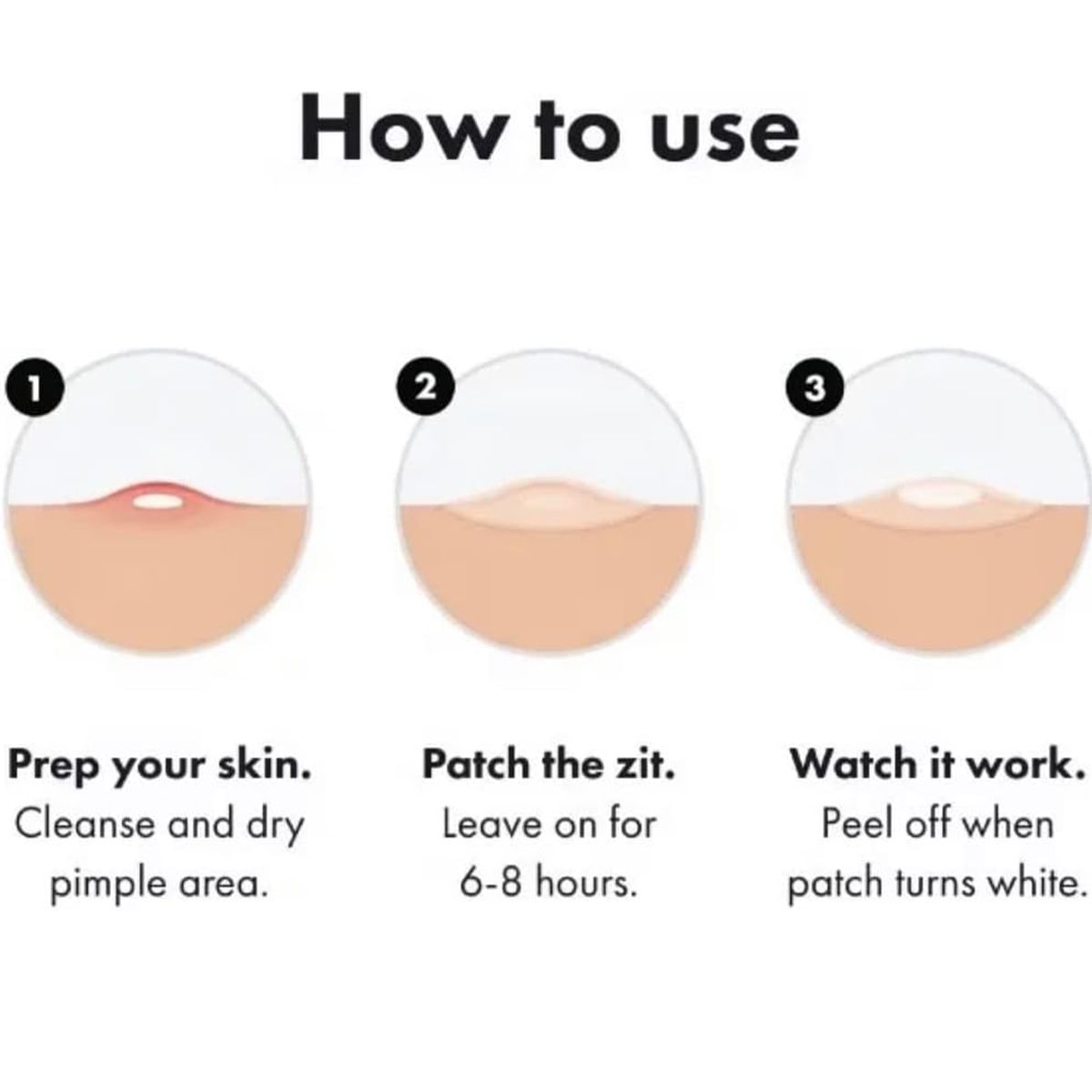 Acne Patches