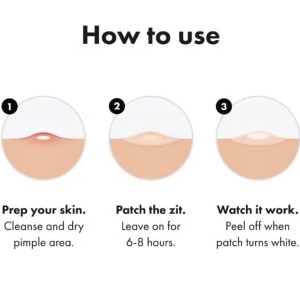Acne Patches